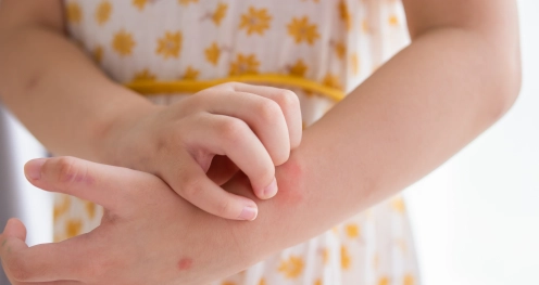 How to get rid of mosquitoes in Kuwait