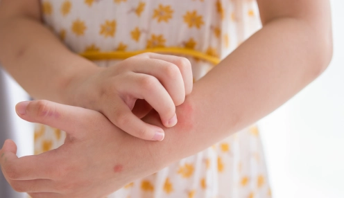 How to get rid of mosquitoes in Kuwait